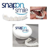 Snap-On Veneers