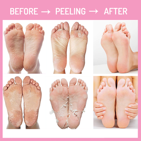 Foot Peeling Mask